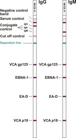 EBV ViraStripe IgG IgM en