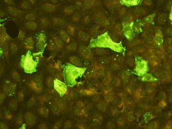 I-MEA01X Measles IgGb